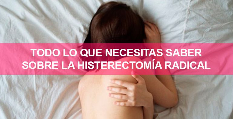 Todo lo que necesitas saber sobre la histerectomía radical