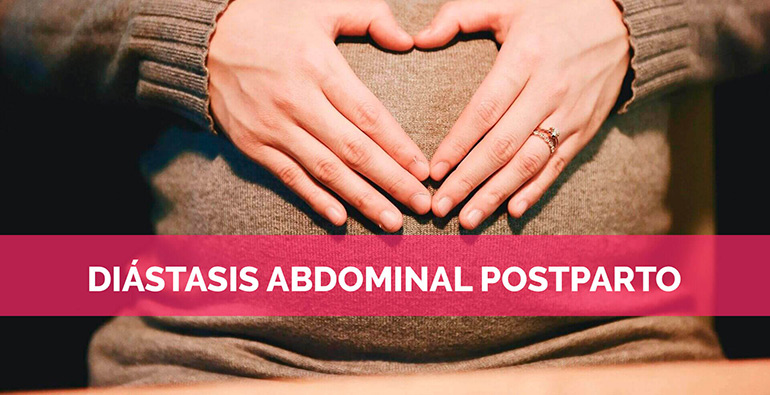 DIÁSTASIS ABDOMINAL POSTPARTO